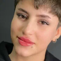 تزریق ژل لب وصورت وبوتاکس