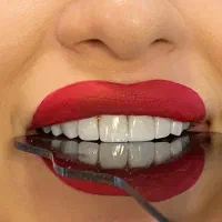 کامپوزیت دندان .۰لیرینگ .لمینت .ونیر|خدمات آرایشگری و زیبایی|ری, تقی آباد|دیوار