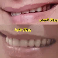 لابراتوار دندانسازی (دندان مصنوعی)|خدمات آرایشگری و زیبایی|اصفهان, جنیران (لادان)|دیوار