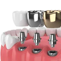 دندانپزشکی/ متخصص جراح فک ولثه /ایمپلنت 9میلیون|خدمات آرایشگری و زیبایی|مشهد, احمدآباد|دیوار