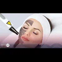 لیزر رفع تیرگی فقط فردا ۳۹۰ تومان