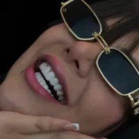 جشنواره کامپوزیت لمینت عصب imax روکش IPSونیر دندان