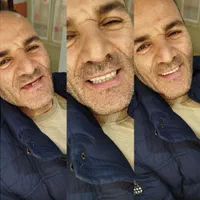 جشنواره دندان مصنوعی خارجی ژله ای با بیمه وضمانت