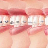 ارتودنسی تخصصی