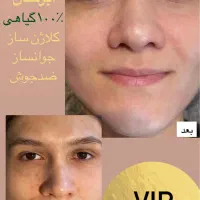 کرم سفیدکننده(آقایان بانوان)ضدلک اصل