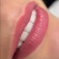 میکروبلیدینگ و میکروپیگمنتیشن