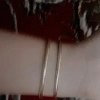 النگو کشی