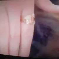 یک عدد انگشتر