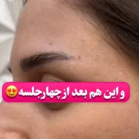 فیشیال وپاکسازی پوست ویژه بانوان|خدمات آرایشگری و زیبایی|سقز, |دیوار