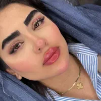 تخفیفات باور نکردین ژل،بوتاکس،آنزیم ،چال گونه