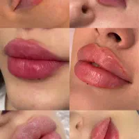 جشنواره تابستانه تزریق ژل، بوتاکس و...|خدمات آرایشگری و زیبایی|تهران, فرمانیه|دیوار