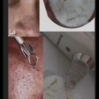 فیشیال کلاسیک|خدمات آرایشگری و زیبایی|دهدشت, |دیوار