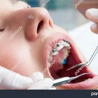 دستیار دندانپزشک مسلط به امور دندانپزشکی