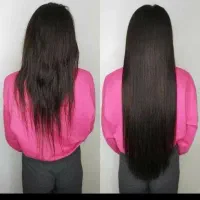 درمان دائمی ریزش مو و پوست و صورت