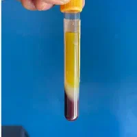 پی آر پی حجامت امبدینگ طب سوزنی زالو بادکش|خدمات آرایشگری و زیبایی|اصفهان, فروردین|دیوار