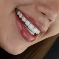 ۲۰٪ تخفیف دندانپزشکی