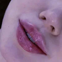 بوتاکس و فیلر. آنزیم تراپی و مزو تراپی