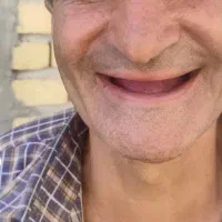 ساخت دندان مصنوعی کامل و تکه ای ضمانتی|آرایشی، بهداشتی، درمانی|مرودشت, بیست متری بیمارستان|دیوار