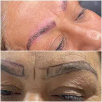 مدل رایگان میکروبلیدینگ فیبروز نیازمندیم