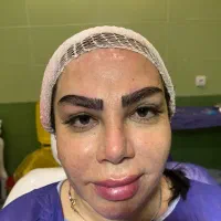 مدل کاشت ابرو