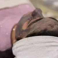 فیشال و پاکسازی بدن