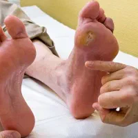 ارائه خدمات تخصصی پرستاری در منزل|خدمات آرایشگری و زیبایی|تهران, مسعودیه|دیوار