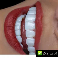 کامپوزیت دندان، روکش، دندانپزشکی تخصصی تهرانسر|خدمات آرایشگری و زیبایی|تهران, تهرانسر مرکزی|دیوار