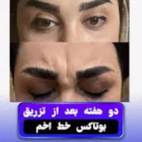 پروتوکین تراپی تخفیف ویژه روز دانشجو