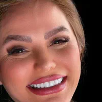 ایمپلنت8 تومن/کامپوزیت2تومن/عصب کشی/لمینت|خدمات آرایشگری و زیبایی|مشهد, سجاد شهر|دیوار