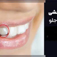 دندان