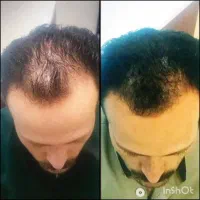 قطره تقویت کننده ابرو گیاهی لدورا وقطره ضد ریزش مو|آرایشی، بهداشتی، درمانی|کرمانشاه, |دیوار