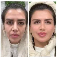 جشنواره هایفوفقط تا امشب ساعت8)با15خدمات رایگان