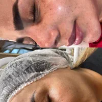 فشیال پاکسازی لیزر پوست جوانساز|خدمات آرایشگری و زیبایی|شیراز, معالی‌آباد|دیوار