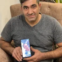 کاشت مو وابرو|خدمات آرایشگری و زیبایی|سقز, |دیوار