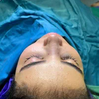 جراحی بینی 23پروتز سینه از 70، لیپو ابدو65|خدمات آرایشگری و زیبایی|تهران, صادقیه|دیوار