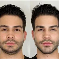 ژل بوتاکس ژل لب فیلر بادی نخ لیفت فیلر زیر چشم|خدمات آرایشگری و زیبایی|اصفهان, جلفا|دیوار