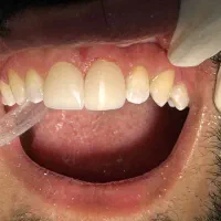 کلینیک دندانپزشکی در کمپلو ارائه تمام خدمات دندان|خدمات زیبایی و سلامت|اهواز, کمپلو جنوبی|دیوار