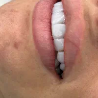 کامپوزیت با قیمت فوق العاده