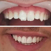 جشنواره دندانپزشکی دکتر یگانه میدان سرقنات|خدمات آرایشگری و زیبایی|قدس, شهرقدس|دیوار