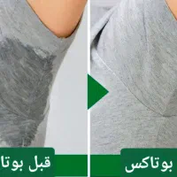 خدمات تخصصی بوتاکس و فیلر در منزل (پزشک مجرب)|خدمات آرایشگری و زیبایی|تهران, اباذر|دیوار