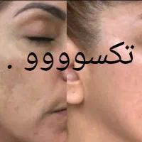 پک روشن کننده صورت و بدن|آرایشی، بهداشتی، درمانی|اهواز, امانیه|دیوار