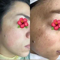 مدل  پاکسازی پوست و ناخن