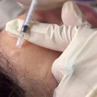 جشنواره پاییزه جوانسازی پوست فیشال پی ارپی اگزوزم|خدمات آرایشگری و زیبایی|مشهد, کوشش|دیوار