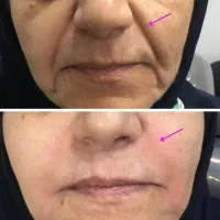 تخفیف ویژه ۳ روزه محصولات بیوممتیک ضدچروک جوانساز