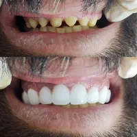 نیازمند دستیار دندانپزشک