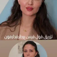 فیلر بادی ،تزریق ژل و بوتاکس با بهترین متریال قیمت|خدمات آرایشگری و زیبایی|دزفول, |دیوار