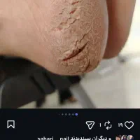 پدیکور پ پارافین