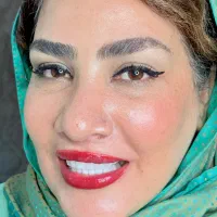 کامپوزیت دندان اقساط