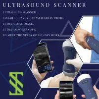 سونوگرافی وایرلس کمپانی Viatom|پزشکی|تهران, پونک|دیوار