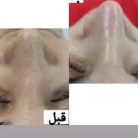 فیشیال